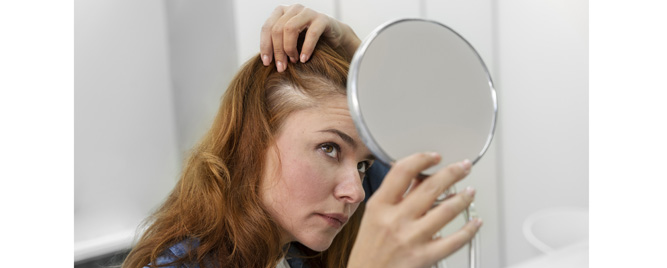 Novi JAK inhibitor pokazao snažan efekat u lečenju teške alopecije areate