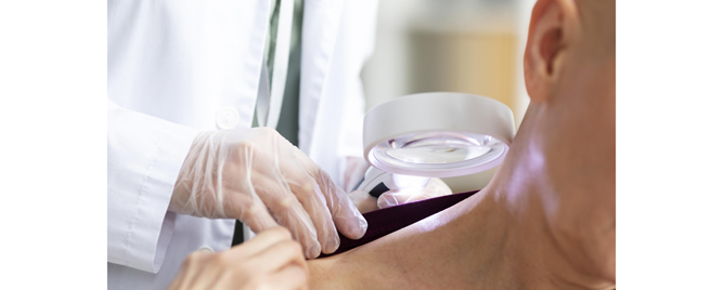 Kakvi su rezultati skrining programa za tumore kože na mortalitet od melanoma u Nemačkoj?