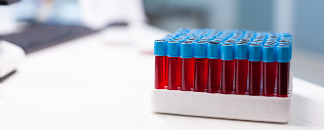 Brže i sigurnije do odgovora kod sumnje na infarkt: Elecsys® Troponin T hs Gen 6